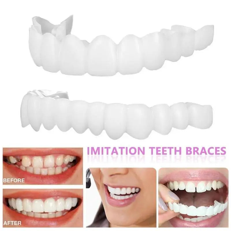 2Pair/set Snap On Teeth Veneers Cover The Yellow Damaged Teeth Instant Confidence Smile Temporary Hygiene Tools For Woman Man